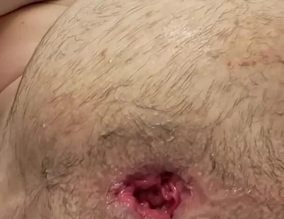 Teen Fisting Gaping Asshole Hard