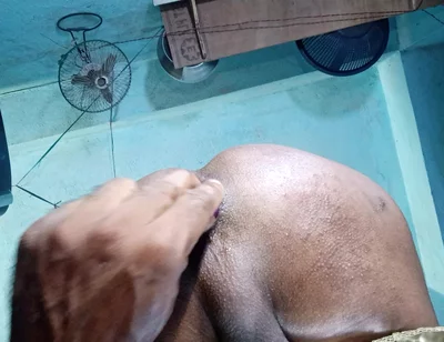 Anal sex