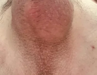Do You Like Shaved or Hairy?