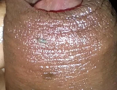 Close-up of Foreskin and Ejaculation in My Pants