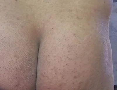 First Time Using an Inflatable Anal Ball