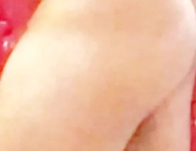 Whip-lash