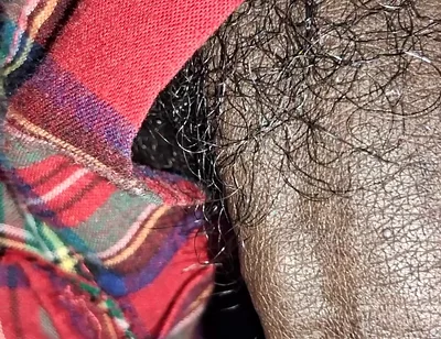 Close up on These Thick Veins