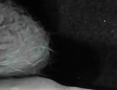 Arc of Sperm, Solo Amateur, Fountain