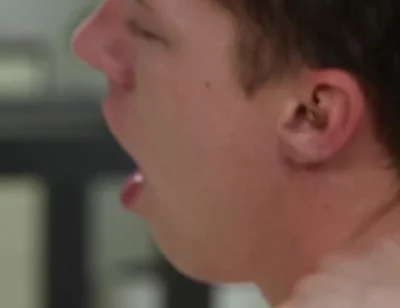 Exposed