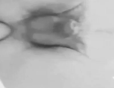 Anal Plaisure