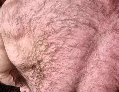 Hairy Muscle Back