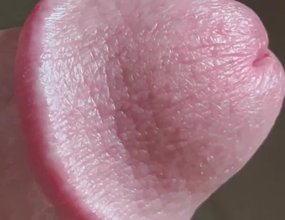 Closeup of Penis with One Vein