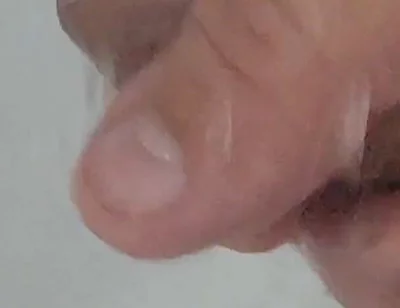 Strong Water in the Foreskin Excites the Glans Precum.