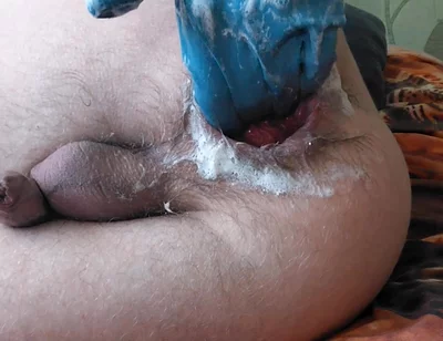 I'm Manually Masturbating My Prolapse, Fisting Myself.