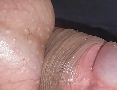 Amazing Upright Rough Venous Frenulum.