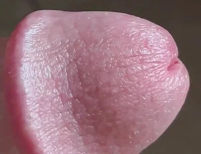 Closeup of Penis with One Vein
