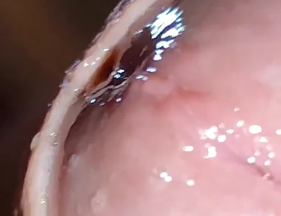 Glans Eye Watering After Intense Fucking.