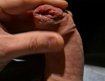 Leaking Precum From My Tight Foreskin