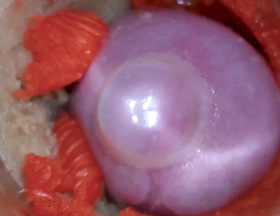 The Camera Inside the Deep Pussy Records a Huge Ejaculation with a Stuck Condom 4K