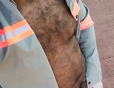 My Hairy Body
