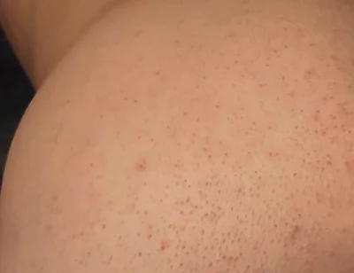 Big Black Dildo Fucks My Ass