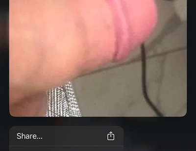 Is It Really Good Vibes Only When Your Willy Is a Silly Lily?