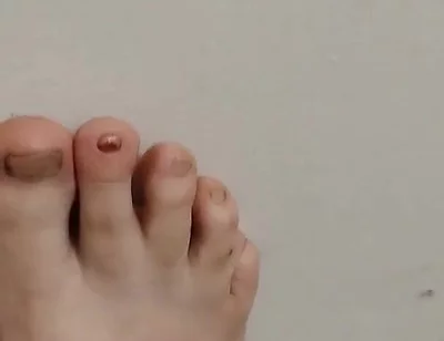 11-26-2025 Cute Little Toes