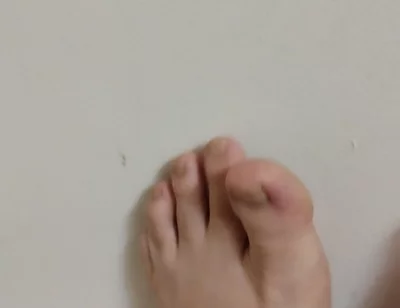 11-26-2025 Cute Little Toes