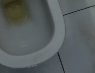 Homemade Method for Freezing the Penis
