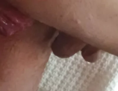 Prolapse and Urine