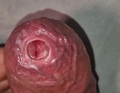 Close up on Phimosis Large Cock, so Hot!