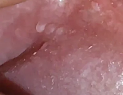 Super Daddy Enlarged Hole Pulsing with Horniness.