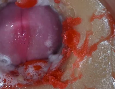 Insemination - Internal Camera Captures Deep Male Ejaculation