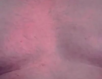 Brust Raus Nippel