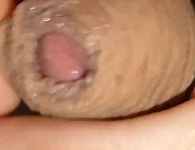 Cumshot of the Largest Phimosis Foreskin in the World.